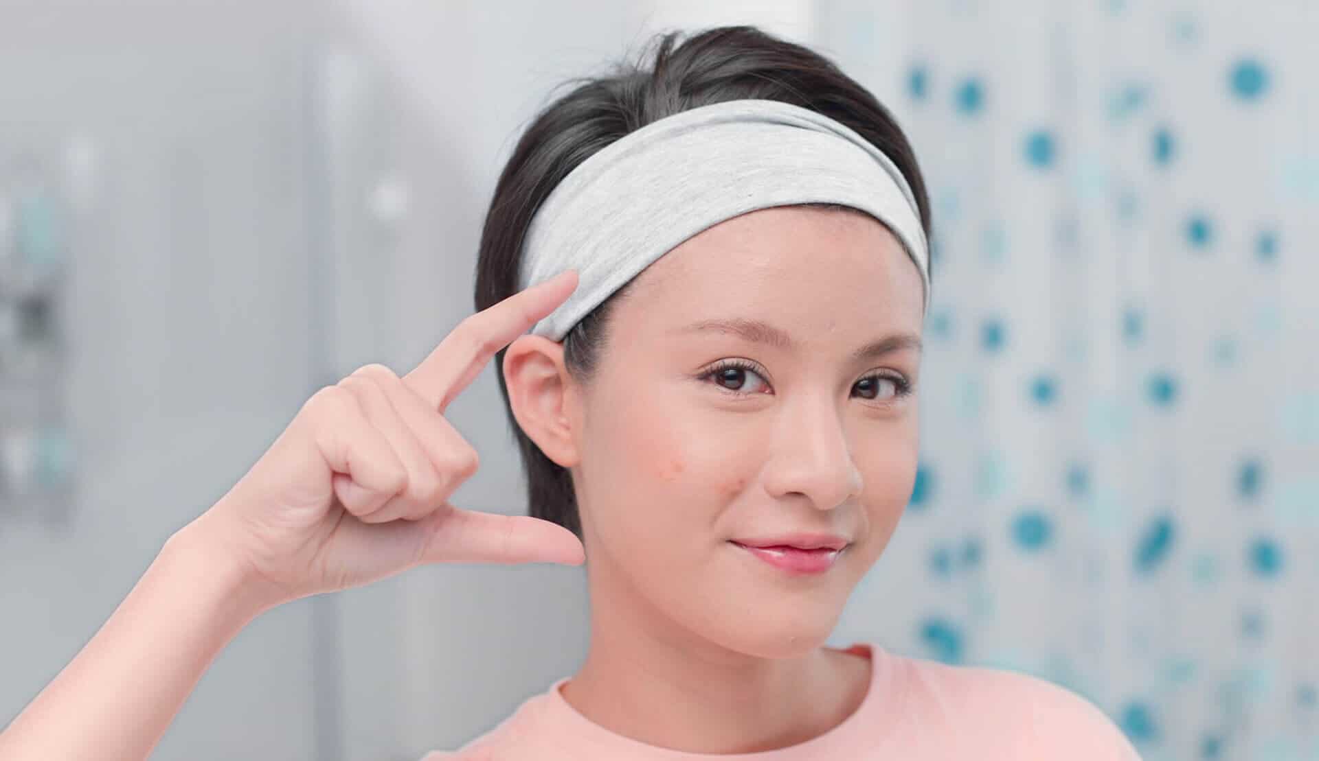 Acne Scarring(TH ADVICE ) Acne Scarring(TH ADVICE )
